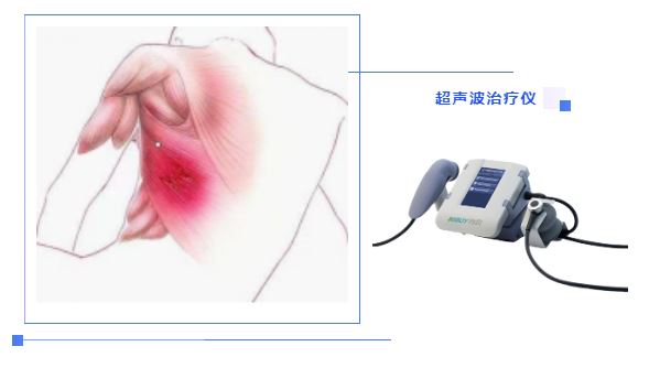 超聲波在軟組織損傷的臨床應用1.png